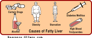 Causes of Fatty Liver.jpg