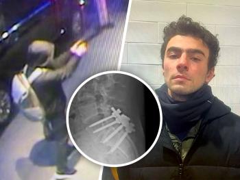 luigi-mangione_credit-NYPD_Altoona PD_Luigi Mangione-X - Beliefnet News