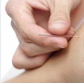 Acupuncture Needle1.jpg
