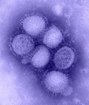 H1N1_flu_blue_sml.jpg