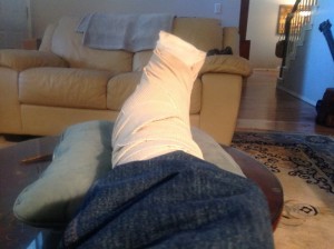 glen's broken ankle