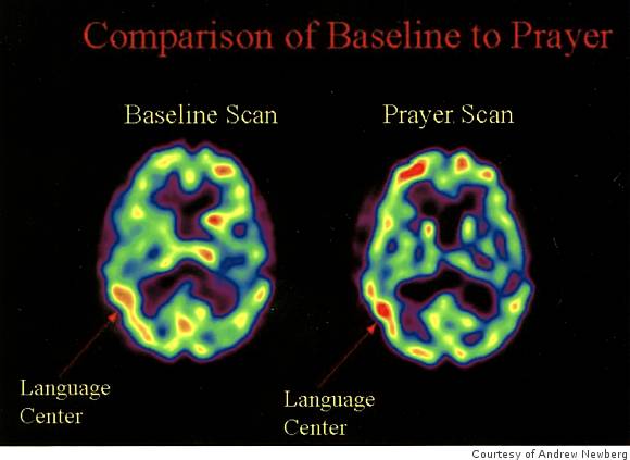 brain scans.jpg